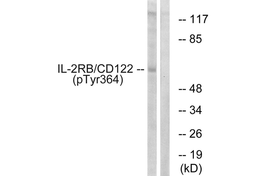 Western blot - IL-2Rβ/CD122 (Phospho-Tyr364) Antibody from Signalway Antibody (11697) - Antibodies.com