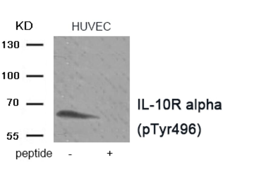 Western blot - IL-10R alpha (Phospho-Tyr496) Antibody from Signalway Antibody (11922) - Antibodies.com