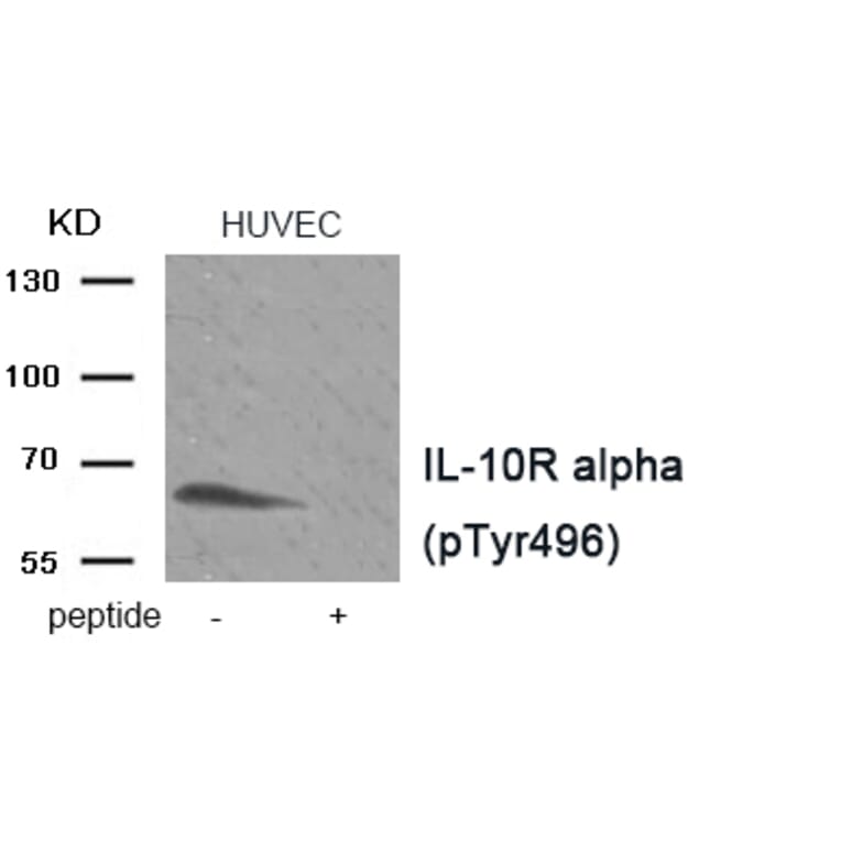 Western blot - IL-10R alpha (Phospho-Tyr496) Antibody from Signalway Antibody (11922) - Antibodies.com