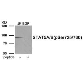Western blot - STAT5A/B (Phospho-Ser725/730) Antibody from Signalway Antibody (11977) - Antibodies.com