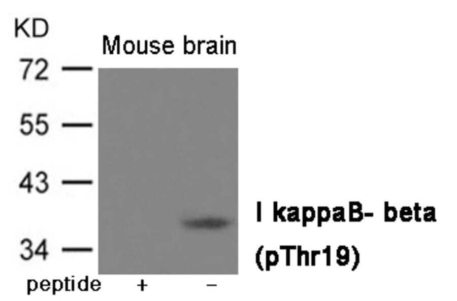 Western blot - IkappaB- beta (Phospho-Thr19) Antibody from Signalway Antibody (12011) - Antibodies.com