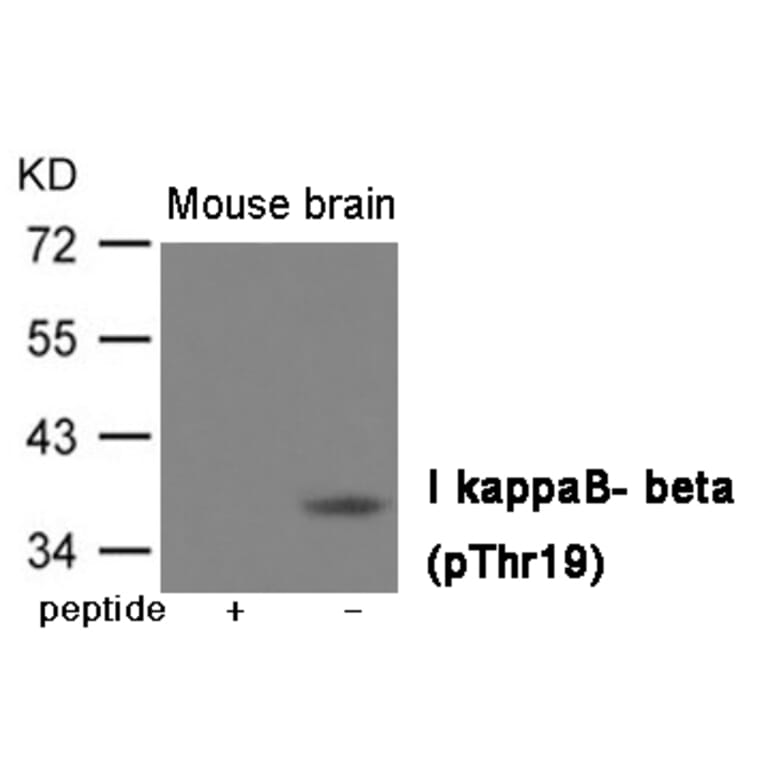 Western blot - IkappaB- beta (Phospho-Thr19) Antibody from Signalway Antibody (12011) - Antibodies.com