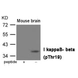 Western blot - IkappaB- beta (Phospho-Thr19) Antibody from Signalway Antibody (12011) - Antibodies.com