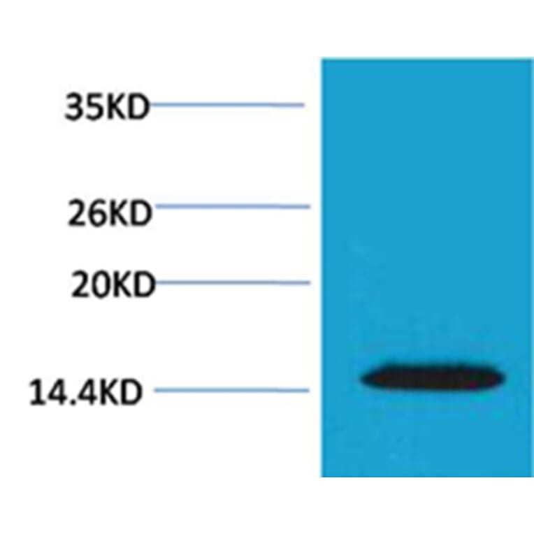 Western blot - Histone H2A.X (Phospho-Thr120) Rabbit Polyclonal Antibody from Signalway Antibody - Antibodies.com