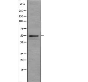 Western blot - Doublecortin (Phospho-Ser378) Antibody from Signalway Antibody (12415) - Antibodies.com