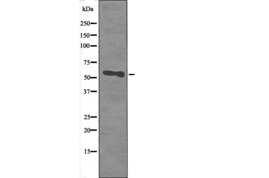Western blot - CD66/CEACAM1 (Phospho-Ser508) Antibody from Signalway Antibody (12425) - Antibodies.com