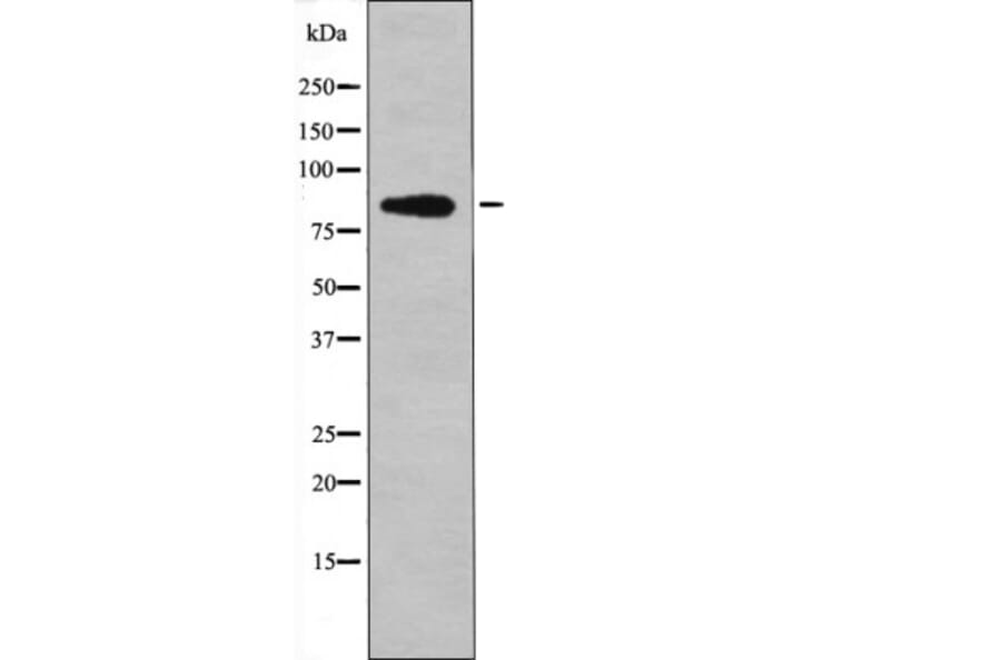 Western blot - Centaurin-β1 (Phospho-Ser554) Antibody from Signalway Antibody (12451) - Antibodies.com