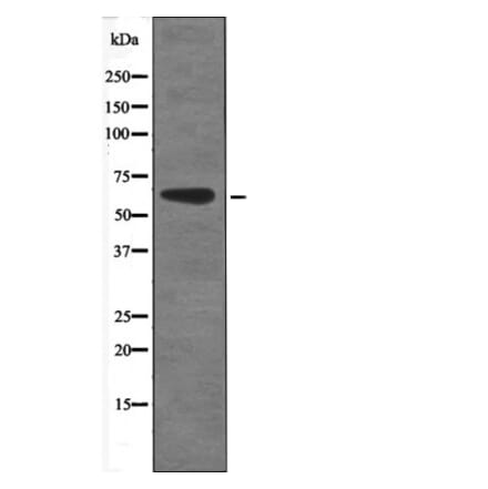 Western blot - CAMKK1/2 (Phospho-Ser458/495) Antibody from Signalway Antibody (12492) - Antibodies.com