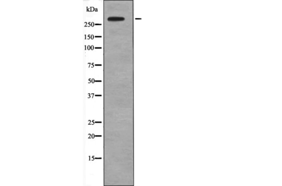 Western blot - IP3 Receptor (Phospho-Tyr353) Antibody from Signalway Antibody (12660) - Antibodies.com