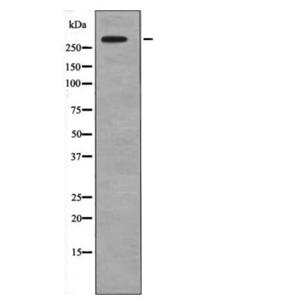 Western blot - IP3 Receptor (Phospho-Tyr353) Antibody from Signalway Antibody (12660) - Antibodies.com