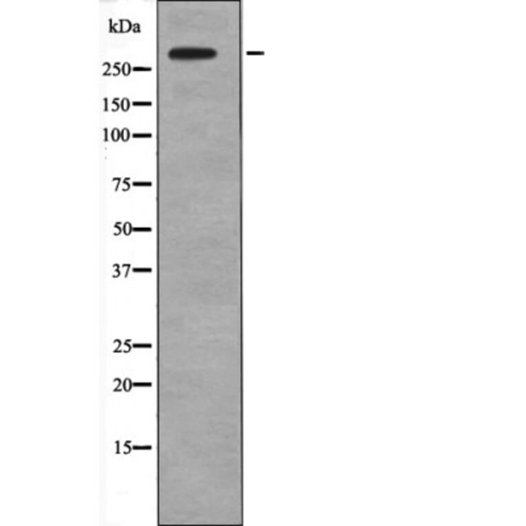 Western blot - IP3 Receptor (Phospho-Tyr353) Antibody from Signalway Antibody (12660) - Antibodies.com