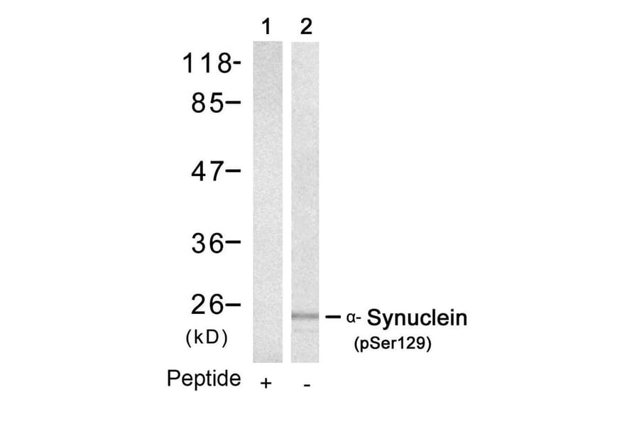 Western blot - a-Synuclein (Phospho-Ser129) Antibody from Signalway Antibody (11171) - Antibodies.com