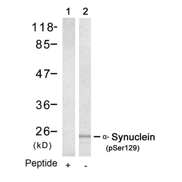 Western blot - a-Synuclein (Phospho-Ser129) Antibody from Signalway Antibody (11171) - Antibodies.com