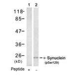Western blot - a-Synuclein (Phospho-Ser129) Antibody from Signalway Antibody (11171) - Antibodies.com