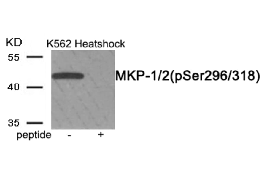 Western blot - MKP-1/2 (Phospho-Ser296/318) Antibody from Signalway Antibody (11947) - Antibodies.com