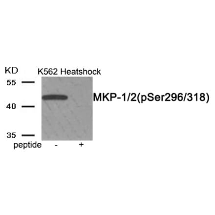 Western blot - MKP-1/2 (Phospho-Ser296/318) Antibody from Signalway Antibody (11947) - Antibodies.com