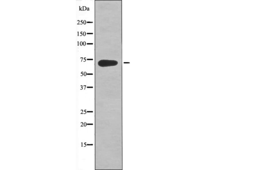 Western blot - Kv4.2/KCND2 (Phospho-Ser616) Antibody from Signalway Antibody (12447) - Antibodies.com