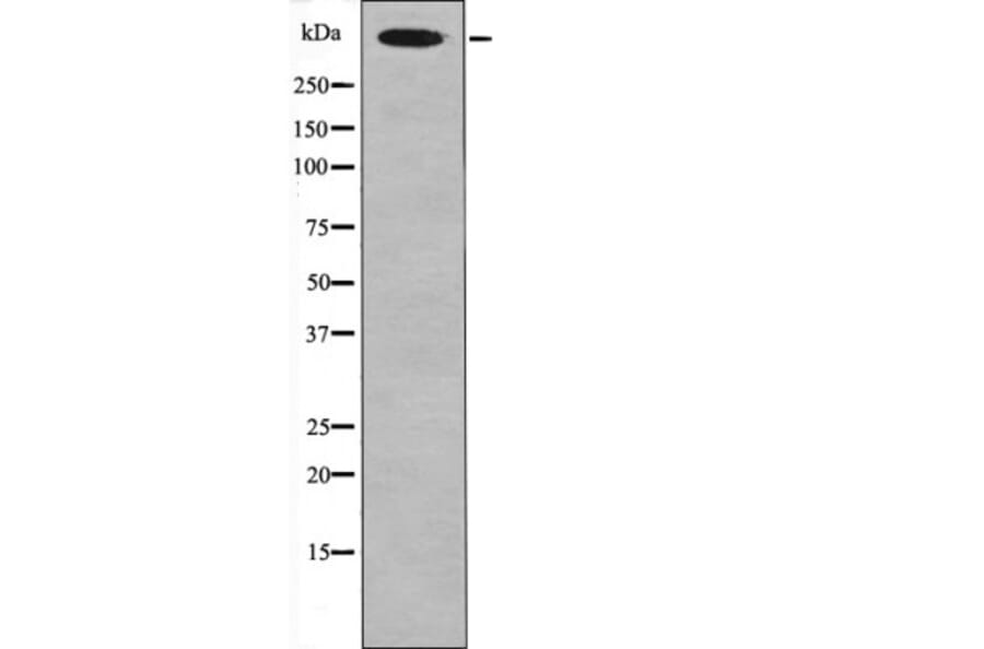 Western blot - Desmoyokin (Phospho-Ser5782) Antibody from Signalway Antibody (12452) - Antibodies.com
