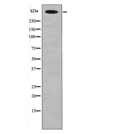 Western blot - Desmoyokin (Phospho-Ser5782) Antibody from Signalway Antibody (12452) - Antibodies.com