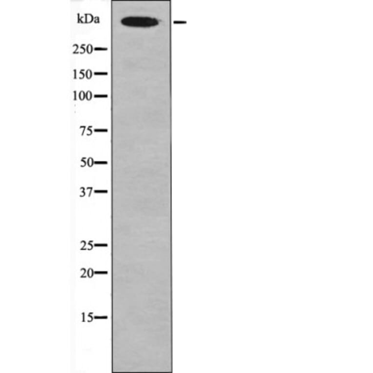 Western blot - Desmoyokin (Phospho-Ser5782) Antibody from Signalway Antibody (12452) - Antibodies.com