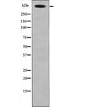 Western blot - Desmoyokin (Phospho-Ser5782) Antibody from Signalway Antibody (12452) - Antibodies.com