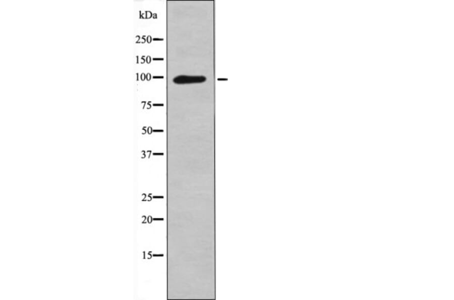 Western blot - FGFR1/2 (Phospho-Tyr730/733) Antibody from Signalway Antibody (12563) - Antibodies.com