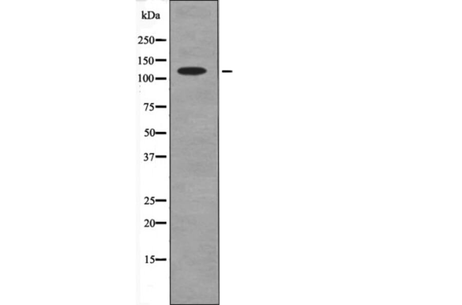Western blot - Ack1 (Phospho-Tyr857+Tyr858) Antibody from Signalway Antibody (12658) - Antibodies.com