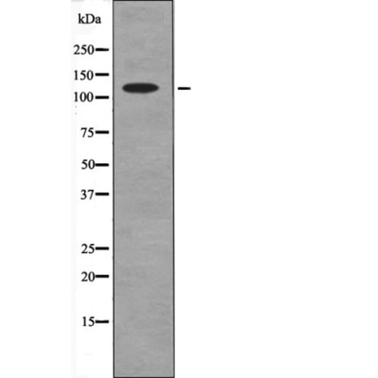 Western blot - Ack1 (Phospho-Tyr857+Tyr858) Antibody from Signalway Antibody (12658) - Antibodies.com