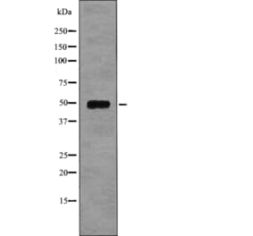 Western blot - EIF5 (Phospho-Ser389+Ser390) Antibody from Signalway Antibody (12751) - Antibodies.com