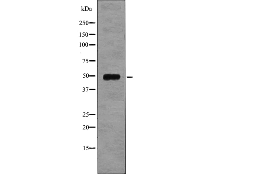 Western blot - EIF5 (Phospho-Ser389+Ser390) Antibody from Signalway Antibody (12751) - Antibodies.com