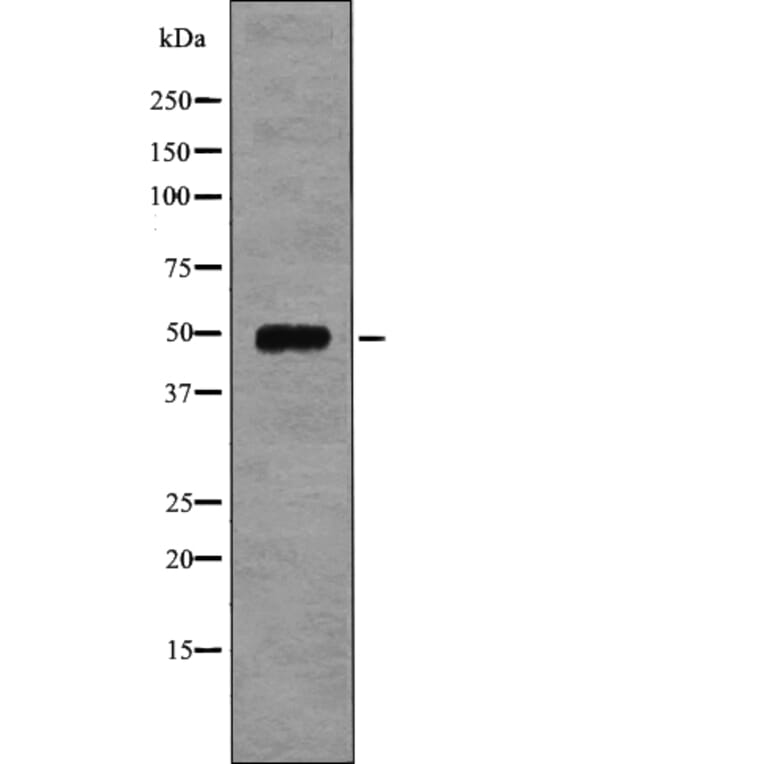 Western blot - EIF5 (Phospho-Ser389+Ser390) Antibody from Signalway Antibody (12751) - Antibodies.com