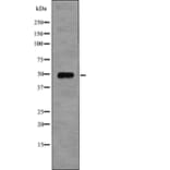 Western blot - EIF5 (Phospho-Ser389+Ser390) Antibody from Signalway Antibody (12751) - Antibodies.com