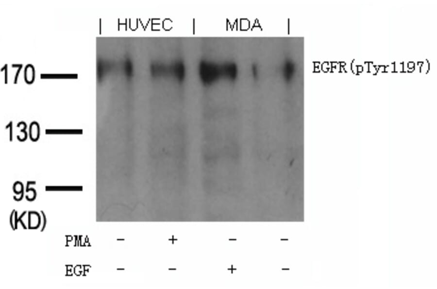 Western blot - EGFR (phospho-Tyr1197) Goat Polyclonal Antibody from Signalway Antibody (11551) - Antibodies.com