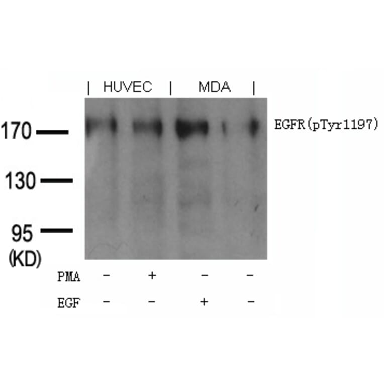 Western blot - EGFR (phospho-Tyr1197) Goat Polyclonal Antibody from Signalway Antibody (11551) - Antibodies.com
