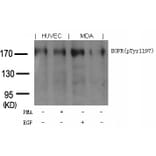 Western blot - EGFR (phospho-Tyr1197) Goat Polyclonal Antibody from Signalway Antibody (11551) - Antibodies.com
