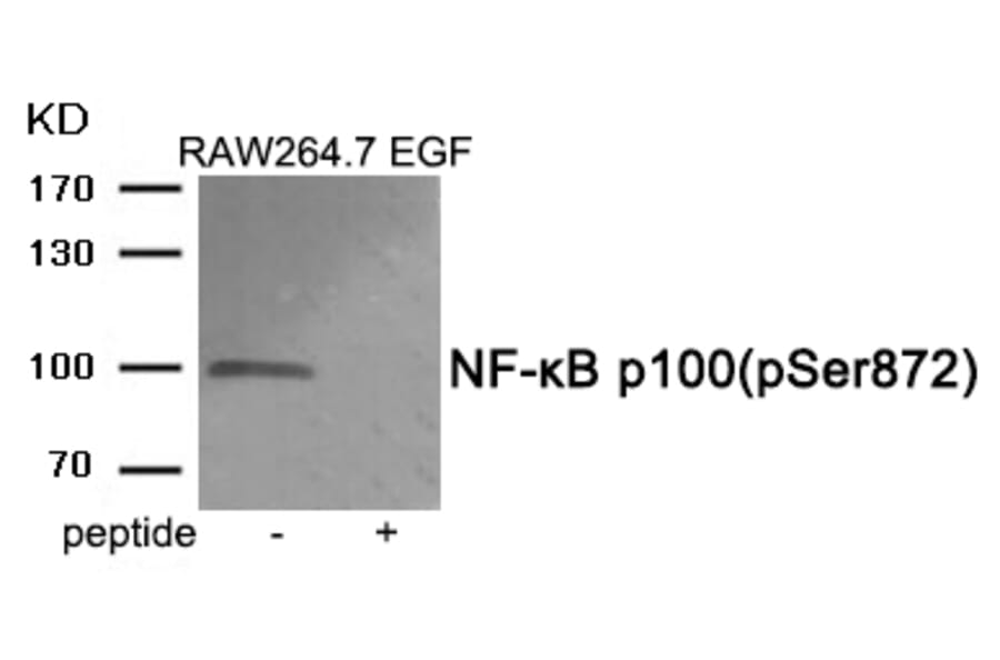 Western blot - NF-κB p100 (Phospho-Ser872) Antibody from Signalway Antibody (11919) - Antibodies.com