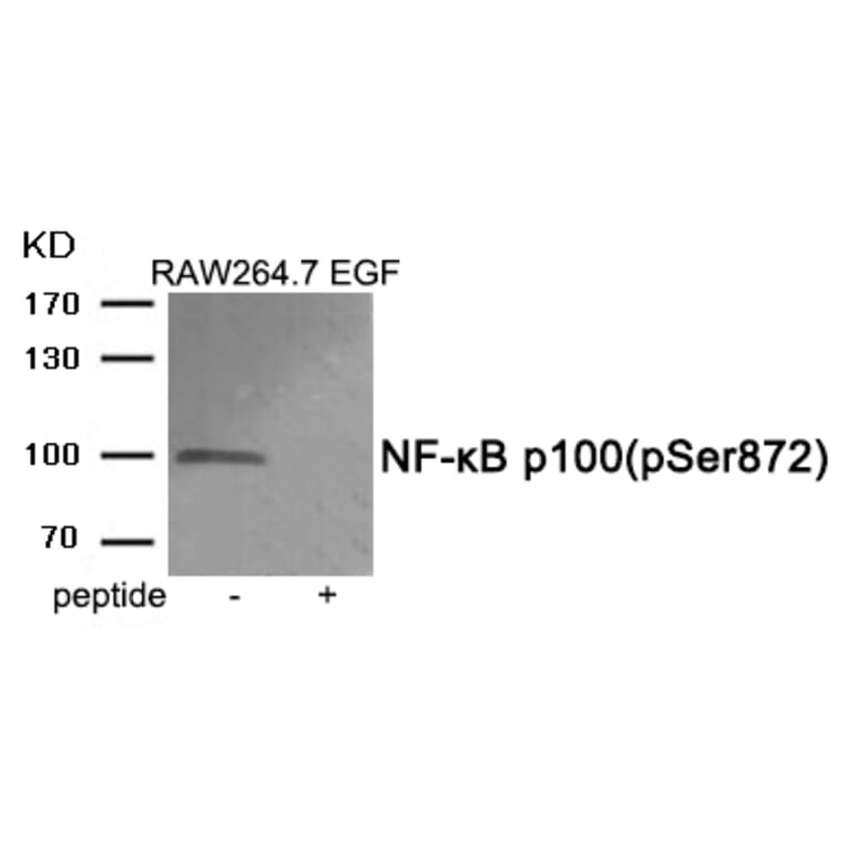 Western blot - NF-κB p100 (Phospho-Ser872) Antibody from Signalway Antibody (11919) - Antibodies.com