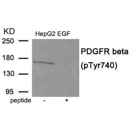 Western blot - PDGFR beta (Phospho-Tyr740) Antibody from Signalway Antibody (11941) - Antibodies.com