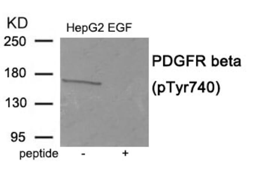 Western blot - PDGFR beta (Phospho-Tyr740) Antibody from Signalway Antibody (11941) - Antibodies.com