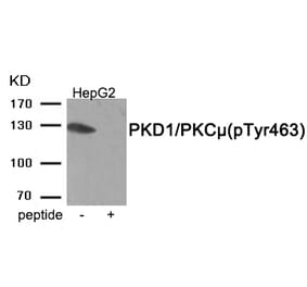 Western blot - PKD1/PKC μ (Phospho-Tyr463) Antibody from Signalway Antibody (11961) - Antibodies.com