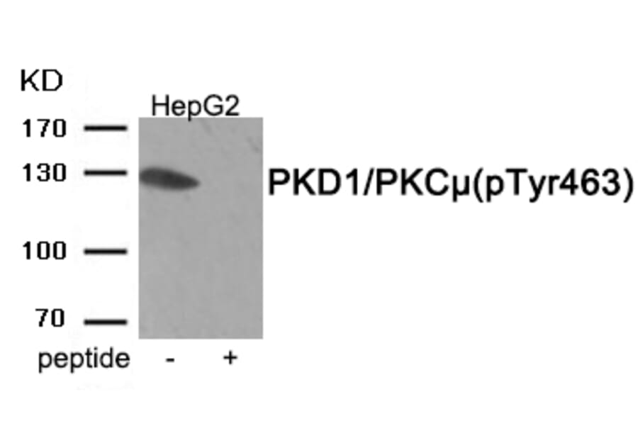 Western blot - PKD1/PKC μ (Phospho-Tyr463) Antibody from Signalway Antibody (11961) - Antibodies.com
