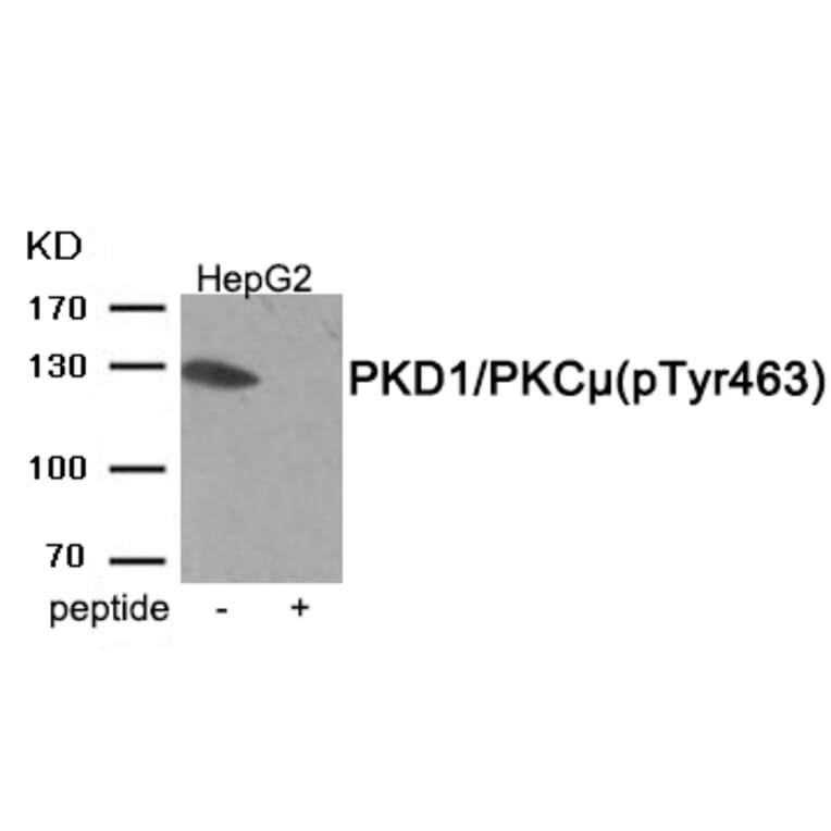 Western blot - PKD1/PKC μ (Phospho-Tyr463) Antibody from Signalway Antibody (11961) - Antibodies.com