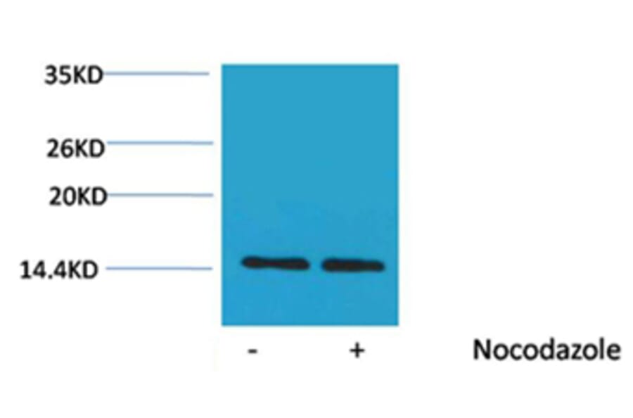 Western blot - Histone H2A (Phospho-Ser129) Rabbit Polyclonal Antibody from Signalway Antibody - Antibodies.com