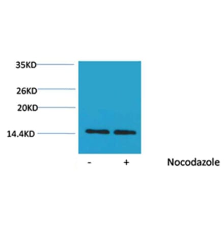 Western blot - Histone H2A (Phospho-Ser129) Rabbit Polyclonal Antibody from Signalway Antibody - Antibodies.com