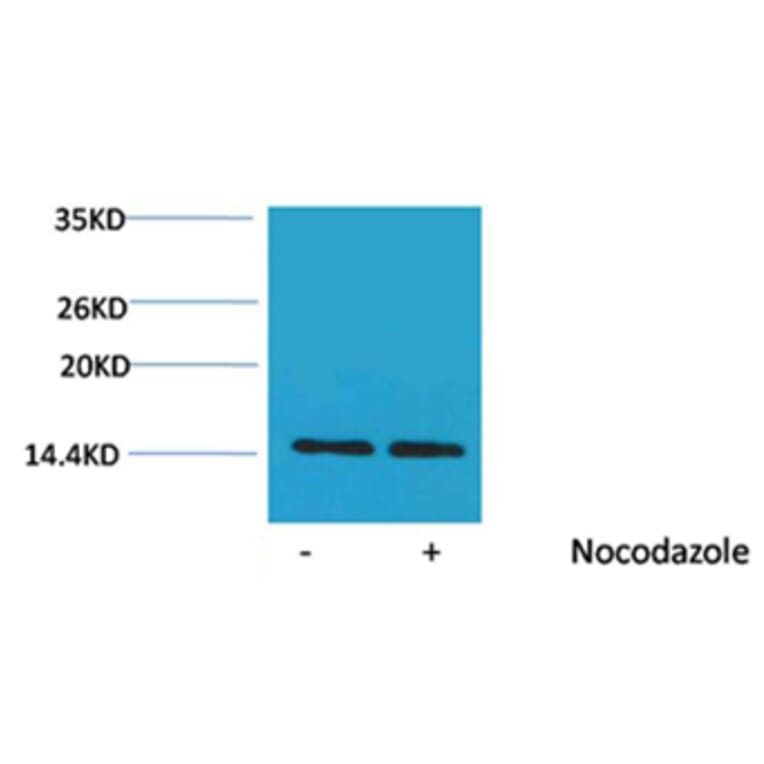 Western blot - Histone H2A (Phospho-Ser129) Rabbit Polyclonal Antibody from Signalway Antibody - Antibodies.com
