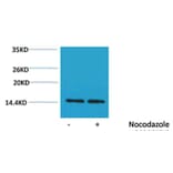 Western blot - Histone H2A (Phospho-Ser129) Rabbit Polyclonal Antibody from Signalway Antibody - Antibodies.com