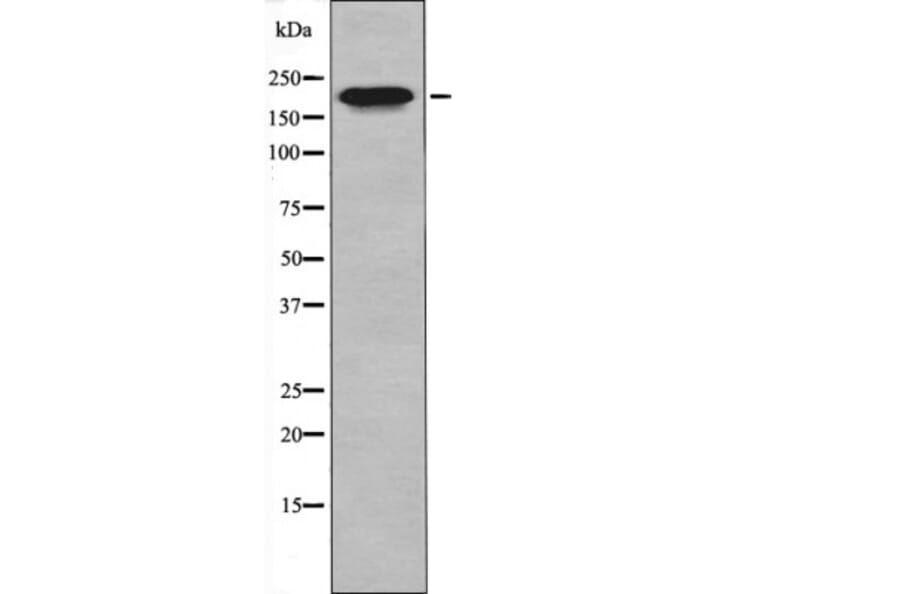 Western blot - MLC-2 (Phospho-Thr17+Ser18) Antibody from Signalway Antibody (12404) - Antibodies.com