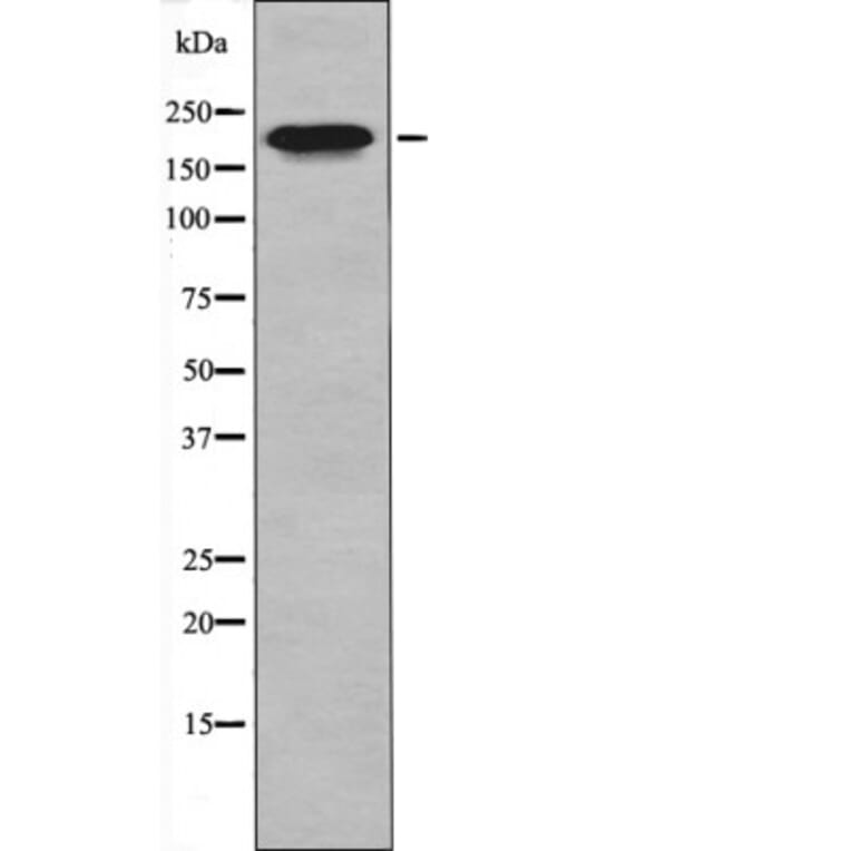 Western blot - MLC-2 (Phospho-Thr17+Ser18) Antibody from Signalway Antibody (12404) - Antibodies.com