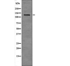 Western blot - JAK2/3 (Phospho-Tyr966/939) Antibody from Signalway Antibody (12510) - Antibodies.com