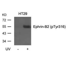 Western blot - Ephrin-B2 (Phospho-Tyr316) Antibody from Signalway Antibody (11188) - Antibodies.com